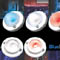 Blues System Launches in North America